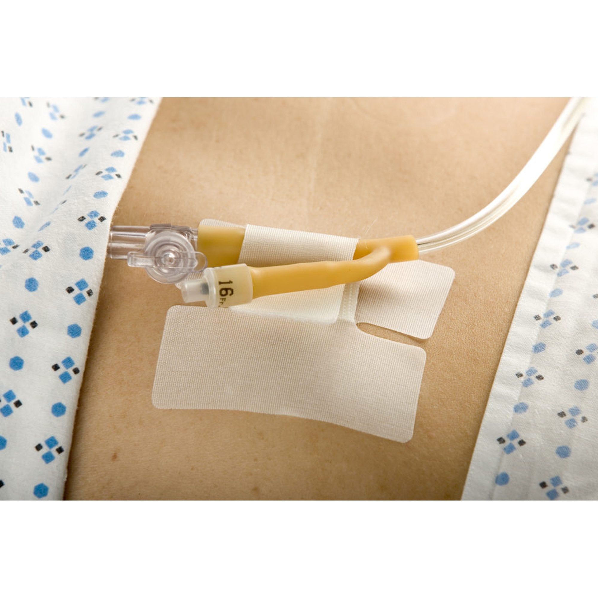 Holder, Tube Cath-Secure Single Hook and Loop Tab, Hypoallergenic Tape, Butterfly Design
