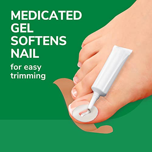Dr. Scholl's Ingrown Toenail Pain Reliever, 0.3oz / Medicated Gel Softens Nails for Easy Trimming and Foam Ring and Bandage Protect the Affected Area