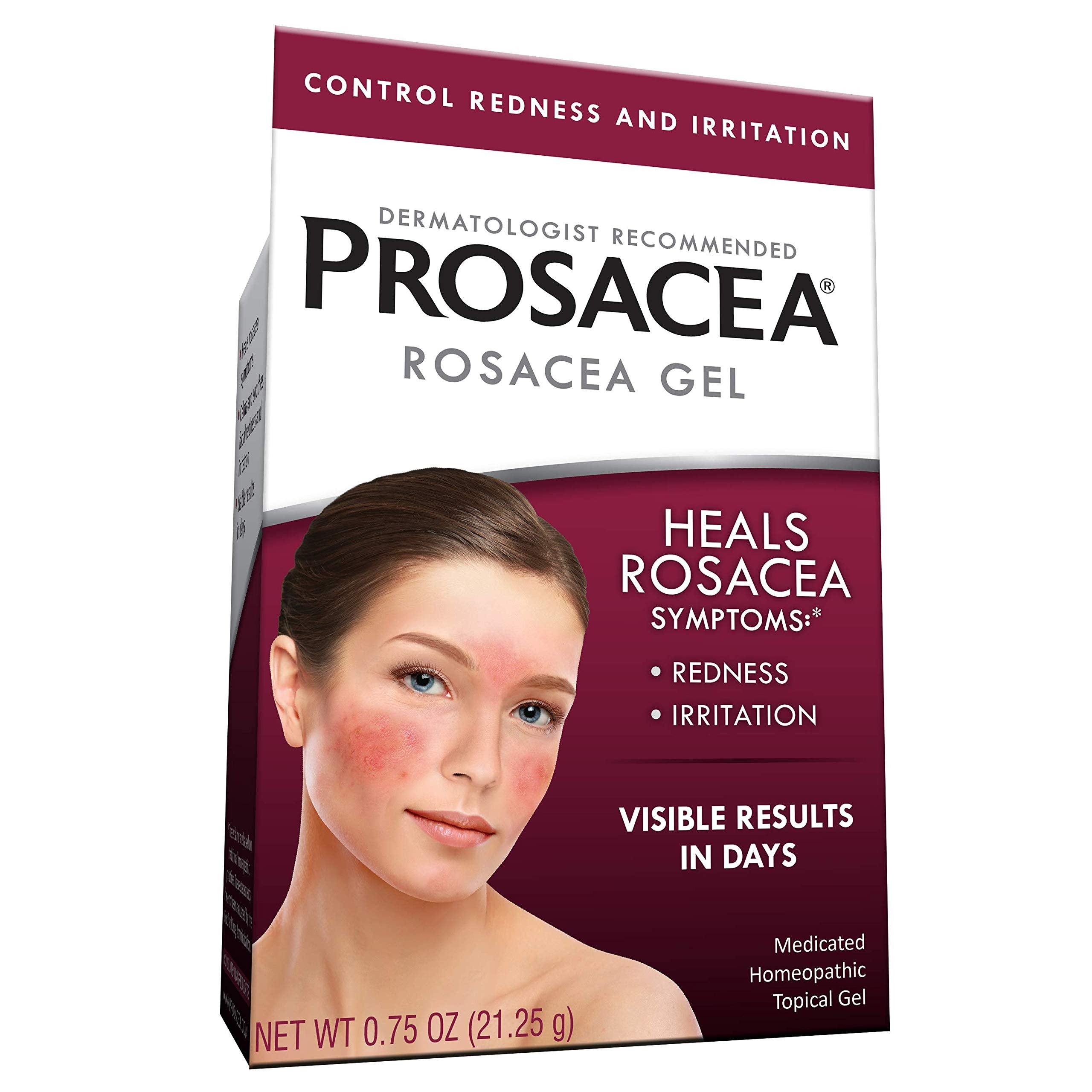 Prosacea - Heals Rosacea Symptoms of Redness, Pimples and Irritation - 0.75 oz