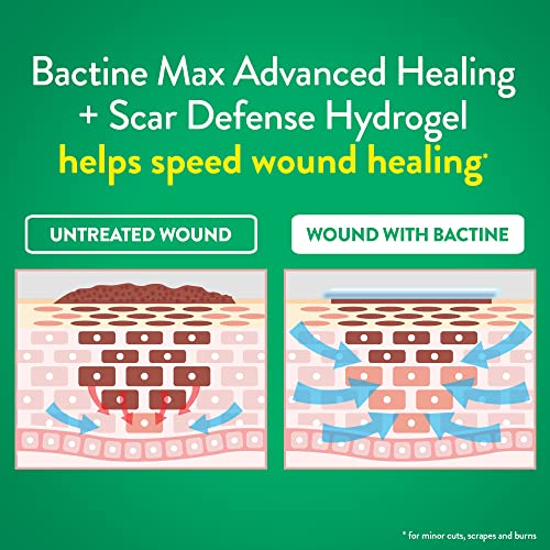 Bactine MAX Advanced Healing Hydrogel For Tattoo Care, Tattoo Recovery, Tattoo After Care, Faster-Healing & First Aid Infection Protection, Petroleum-Free, with Natural Ingredients, 0.75oz